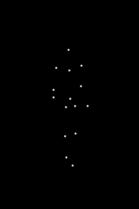 הליכת עצבנית