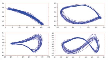 קינסיולוגיה ופיסיולוגיה של הנעת כיסא גלגלים 