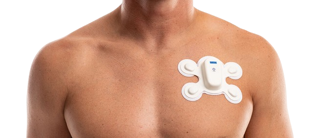 wireless Holter monitoring